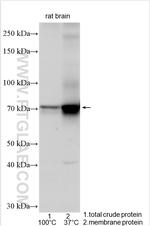 KCND3 Antibody in Western Blot (WB)