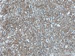 PNPLA4 Antibody in Immunohistochemistry (Paraffin) (IHC (P))