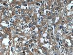 PNPLA4 Antibody in Immunohistochemistry (Paraffin) (IHC (P))