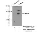 PNPLA4 Antibody in Immunoprecipitation (IP)