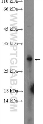 PNPLA4 Antibody in Western Blot (WB)