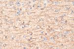 PTPRT Antibody in Immunohistochemistry (Paraffin) (IHC (P))
