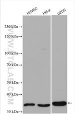 CTGF Antibody in Western Blot (WB)