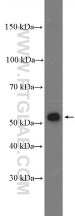 ACSF3 Antibody in Western Blot (WB)