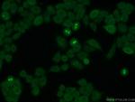 CKAP2 Antibody in Immunocytochemistry (ICC/IF)