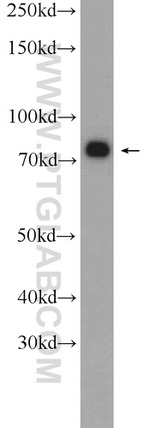 CKAP2 Antibody in Western Blot (WB)