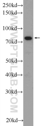 CKAP2 Antibody in Western Blot (WB)