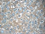 TMEM199 Antibody in Immunohistochemistry (Paraffin) (IHC (P))