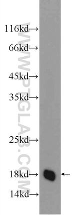 TMEM199 Antibody in Western Blot (WB)