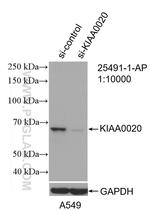 PUF-A, KIAA0020 Antibody in Western Blot (WB)