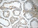 MFSD2 Antibody in Immunohistochemistry (Paraffin) (IHC (P))