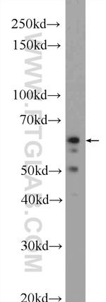 MFSD2 Antibody in Western Blot (WB)