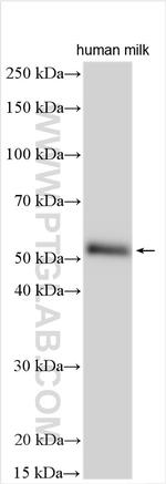 MATN3 Antibody in Western Blot (WB)