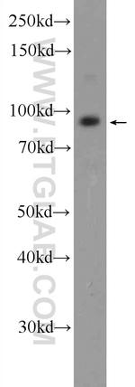 TMEM24 Antibody in Western Blot (WB)