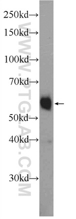 ZNF134 Antibody in Western Blot (WB)