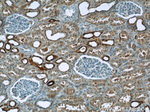TAF15 Antibody in Immunohistochemistry (Paraffin) (IHC (P))