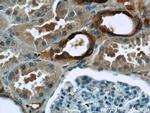 TAF15 Antibody in Immunohistochemistry (Paraffin) (IHC (P))