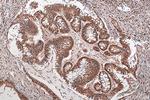 TAF15 Antibody in Immunohistochemistry (Paraffin) (IHC (P))