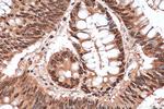 TAF15 Antibody in Immunohistochemistry (Paraffin) (IHC (P))