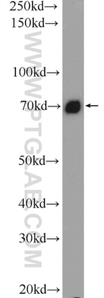 TAF15 Antibody in Western Blot (WB)