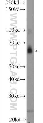 TAF15 Antibody in Western Blot (WB)