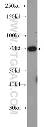 TAF15 Antibody in Western Blot (WB)