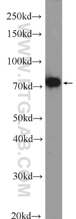 TAF15 Antibody in Western Blot (WB)
