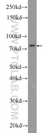 CTTNBP2NL Antibody in Western Blot (WB)