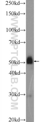 SLC35F2 Antibody in Western Blot (WB)