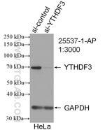 YTHDF3 Antibody in Western Blot (WB)
