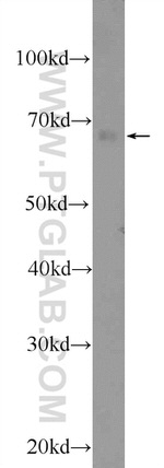 YTHDF3 Antibody in Western Blot (WB)