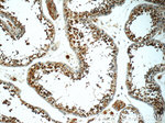 PGBD1 Antibody in Immunohistochemistry (Paraffin) (IHC (P))