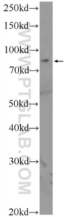PGBD1 Antibody in Western Blot (WB)