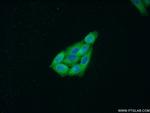 MCP1 Antibody in Immunocytochemistry (ICC/IF)