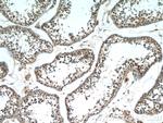 SCML2 Antibody in Immunohistochemistry (Paraffin) (IHC (P))