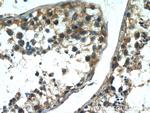 SCML2 Antibody in Immunohistochemistry (Paraffin) (IHC (P))