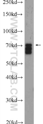 SCML2 Antibody in Western Blot (WB)