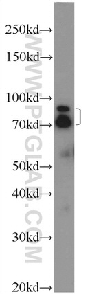 SCML2 Antibody in Western Blot (WB)