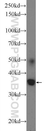 ATRAID Antibody in Western Blot (WB)