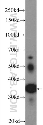 ATRAID Antibody in Western Blot (WB)