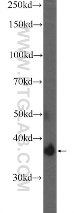 ATRAID Antibody in Western Blot (WB)