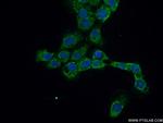 C1orf156 Antibody in Immunocytochemistry (ICC/IF)