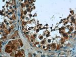 PNLDC1 Antibody in Immunohistochemistry (Paraffin) (IHC (P))