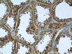 PNLDC1 Antibody in Immunohistochemistry (Paraffin) (IHC (P))