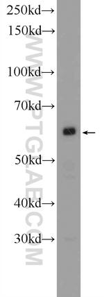 PNLDC1 Antibody in Western Blot (WB)