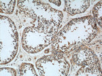 LRRC20 Antibody in Immunohistochemistry (Paraffin) (IHC (P))