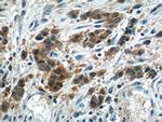 LRRC20 Antibody in Immunohistochemistry (Paraffin) (IHC (P))