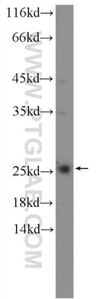 LRRC20 Antibody in Western Blot (WB)