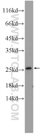 LRRC20 Antibody in Western Blot (WB)