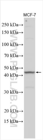 EPHX4 Antibody in Western Blot (WB)
